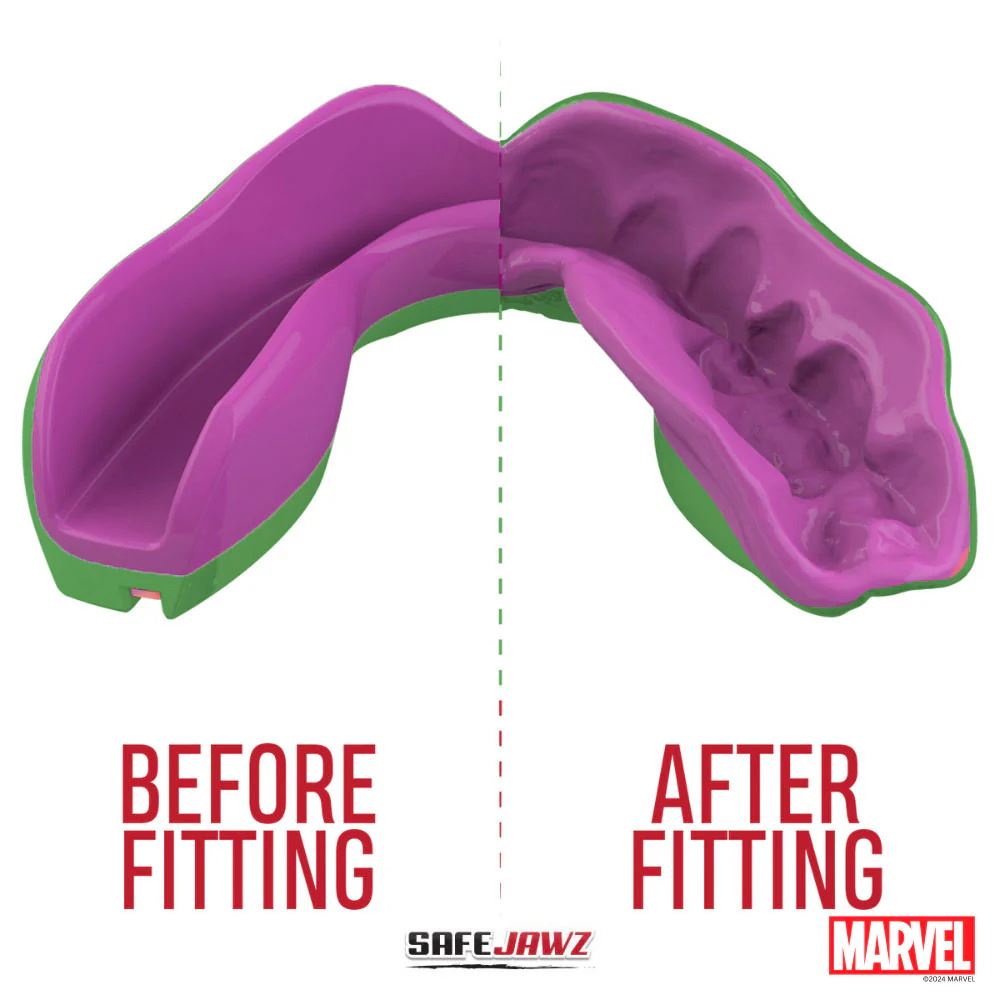 Safejawz Marvel The Hulk Mouthguard