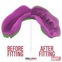 Thumbnail for Safejawz Marvel The Hulk Mouthguard